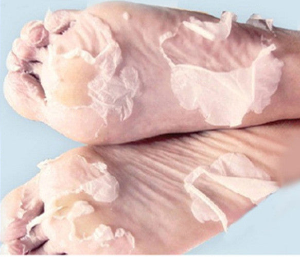 Baby Soft Feet, Our Deep Exfoliating Foot Peel for Sexy Soft Feet